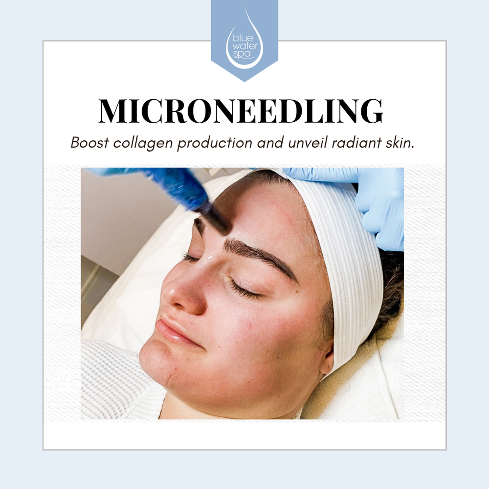 Microneedling of Face & Neck