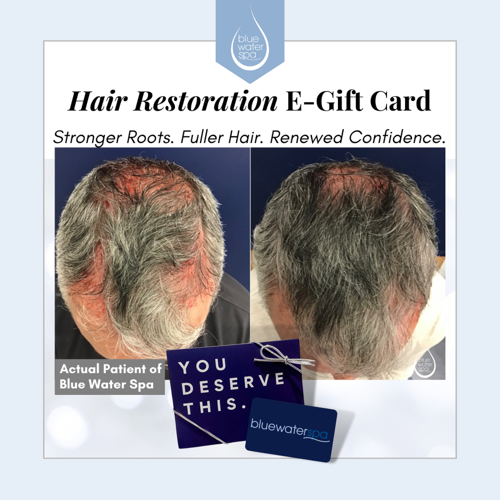Hair Restoration E-Gift Card