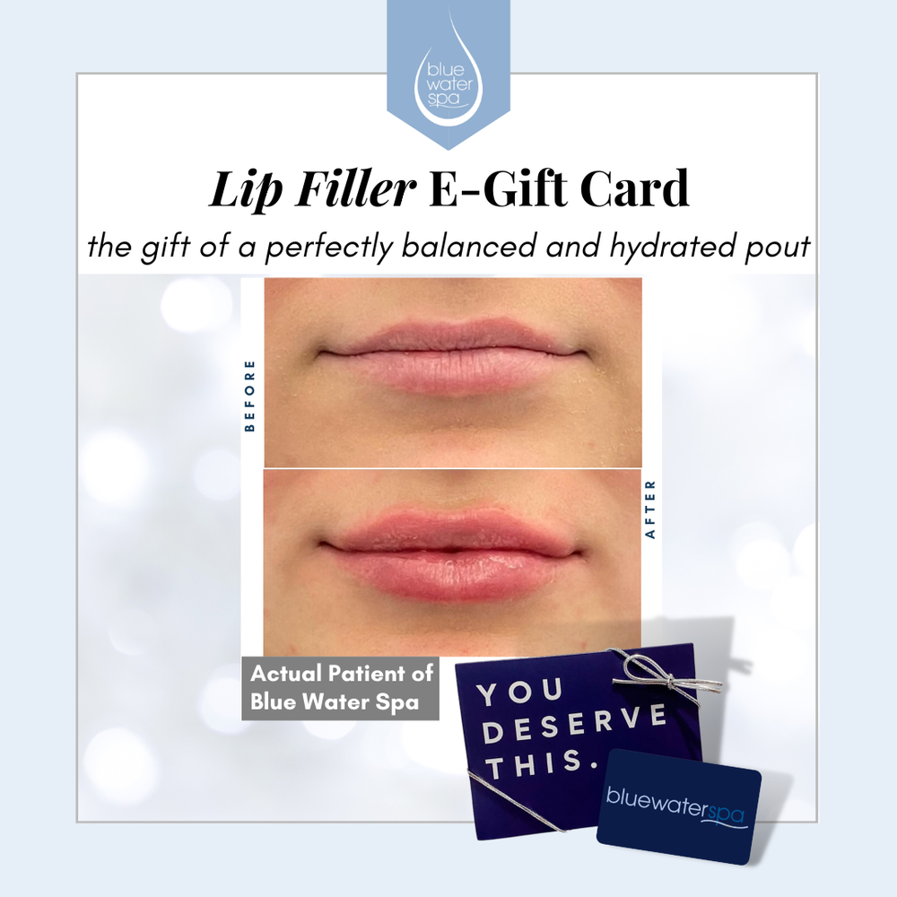 Lip Filler E-Gift Card