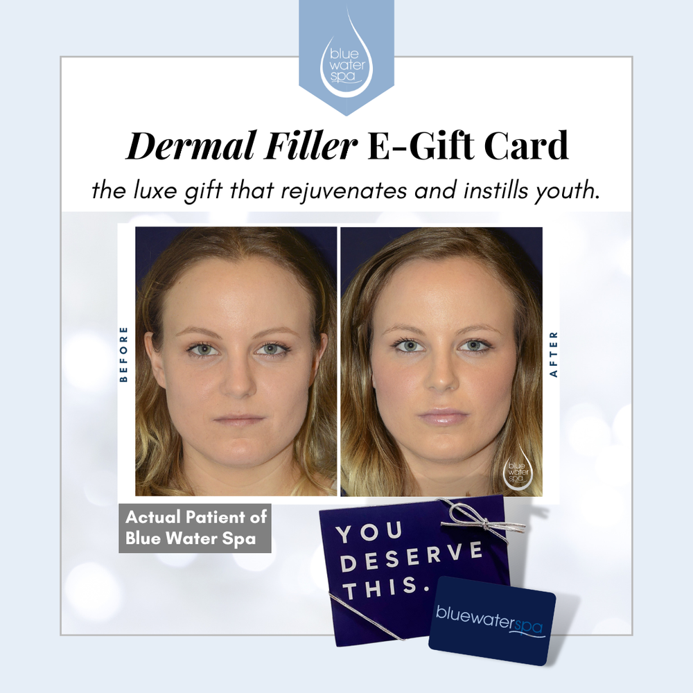 Dermal Filler E-Gift Card