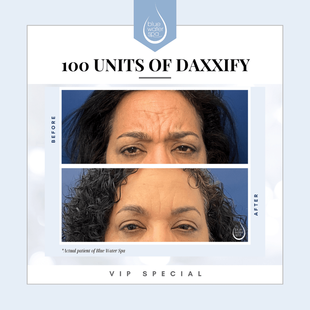 Facial Treatments - 100 Units of Daxxify (VIP) - Blue Water Spa