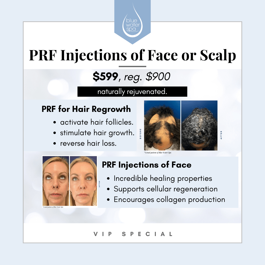 PRF Injectable Treatments | Natural Facial Rejuvenation at Blue Water Spa