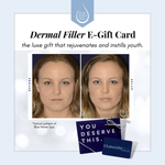 Gift Cards - Dermal Filler E - Gift Card - Blue Water Spa