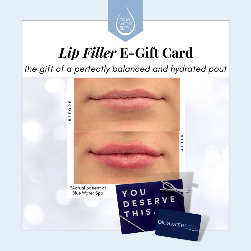 Gift Cards - Lip Filler E - Gift Card - Blue Water Spa