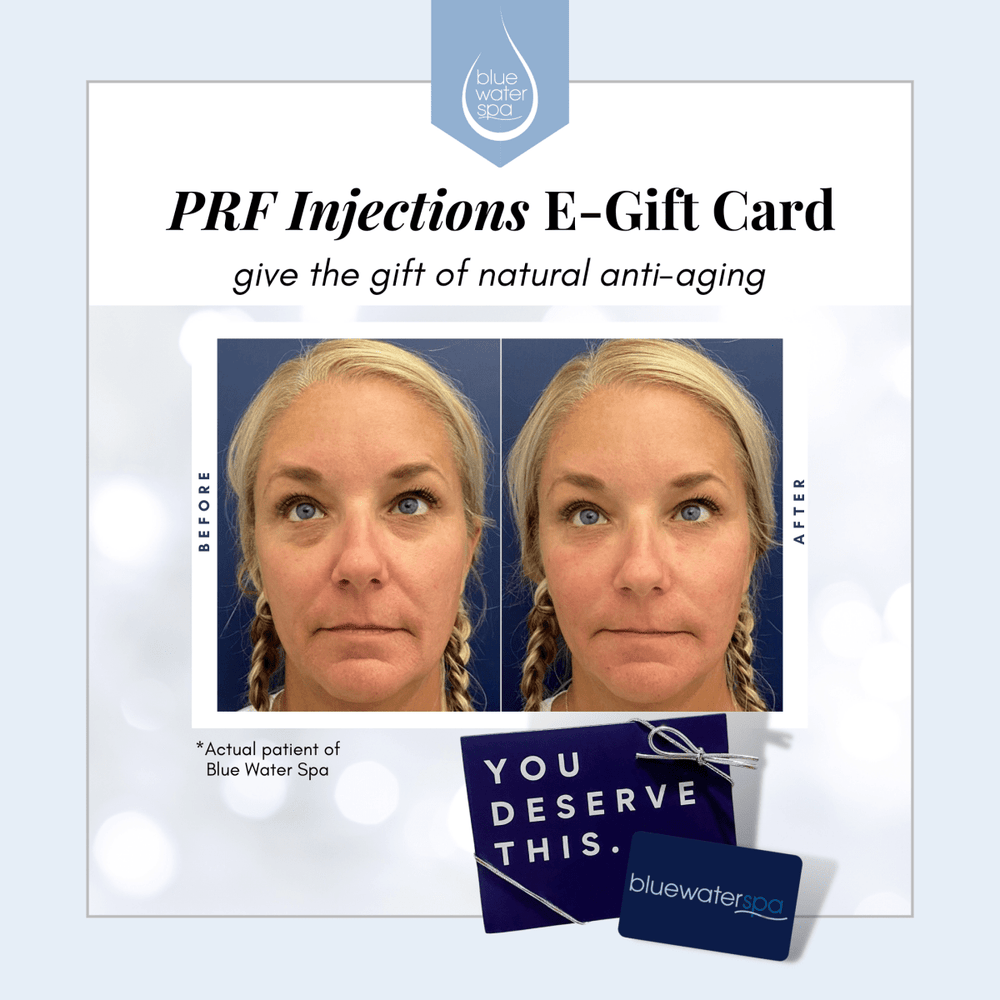 Gift Cards - PRF Injections E - Gift Card - Blue Water Spa