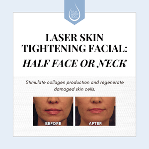 Treatments - Laser Skin Tightening: Half Face or Neck - Blue Water Spa