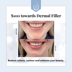 
            
                Load image into Gallery viewer, Body Treatments-Dermal Filler (Birthday)-Blue Water Spa
            
        