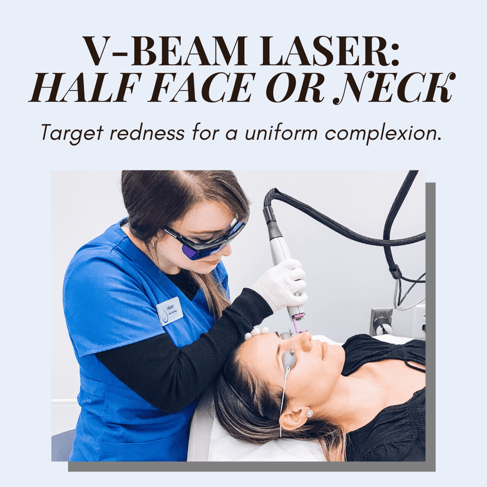 Body Treatments-V-Beam Perfecta Laser: Half Face or Neck-Blue Water Spa