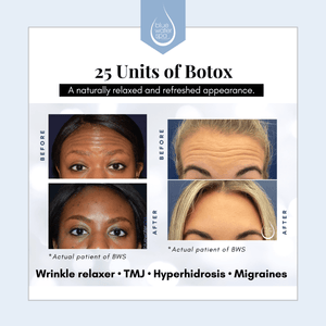 -Botox & Neurotoxin (Birthday)-Blue Water Spa