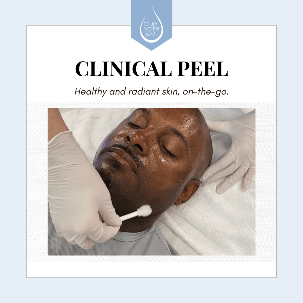 Face Treatments-Clinical Peel-Blue Water Spa