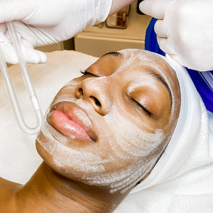 Face Treatments-Microderm-a-Bliss-Blue Water Spa