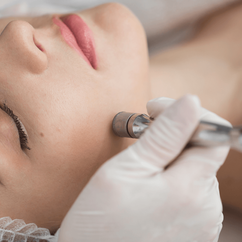 Face Treatments-Microdermabrasion-Blue Water Spa