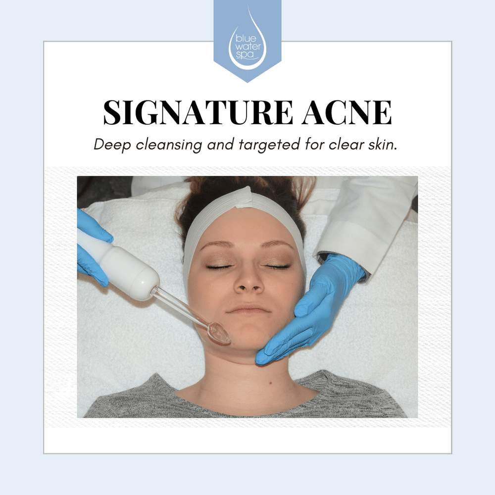 Face Treatments-Signature Acne Treatment-Blue Water Spa