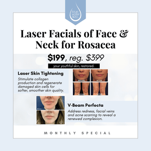 Treatments-Laser Facials for Rosacea-Blue Water Spa