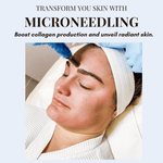 Treatments-Microneedling - Level 1-Blue Water Spa