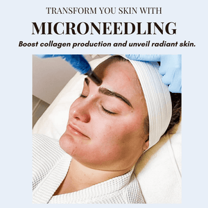 
            
                Load image into Gallery viewer, Treatments-Microneedling - Level 1-Blue Water Spa
            
        