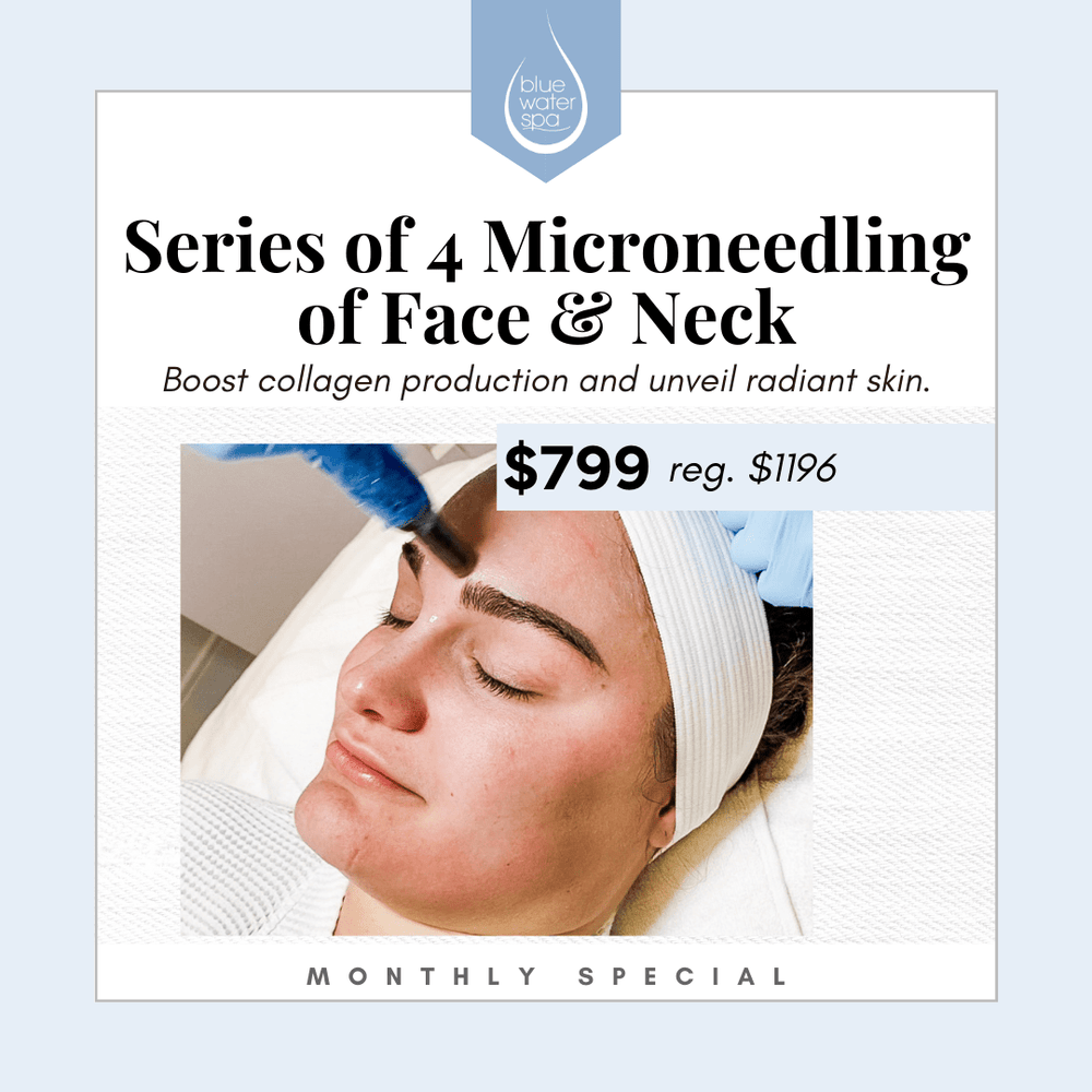 Treatments-Series of 4 Microneedling Treatments-Blue Water Spa